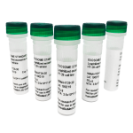 Lyophilized exosomes from urine of healthy donors (5x30µg vial) Lyophilized exosomes from urine of healthy donors (5x30µg vial)